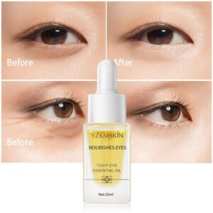 Natural Eye Essence Oil – OEM/ODM System for Pure Eye Care, Reduces Wrinkles and Advantageous Traces, Anti-Growing older Therapy for Darkish Circles and Eye Luggage