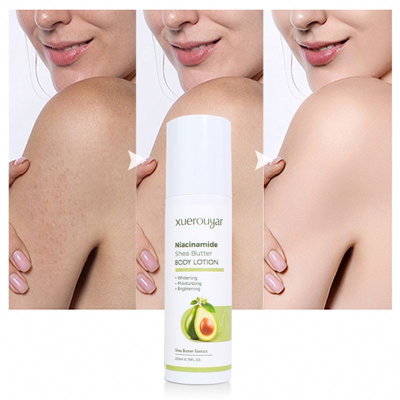 Pure Natural Physique Lotion for Black Pores and skin - Moisturizing and Whitening Skilled Care Cream